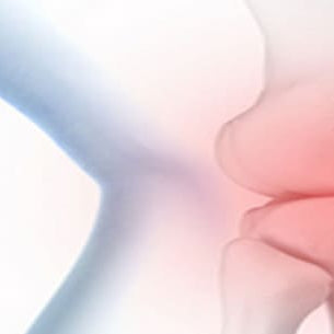 Qué es la osteoartritis y la gonartrosis