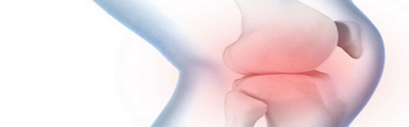 Qué es la osteoartritis y la gonartrosis